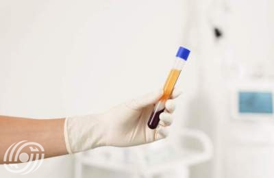 انطلاق المؤتمر الإيراني الثاني للبلازما الطبية انطلاق المؤتمر الإيراني الثاني للبلازما الطبية